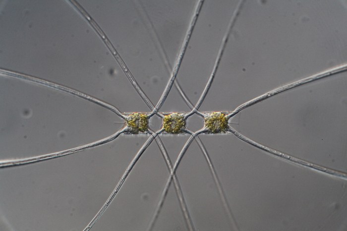 Chaetoceros_atlanticus